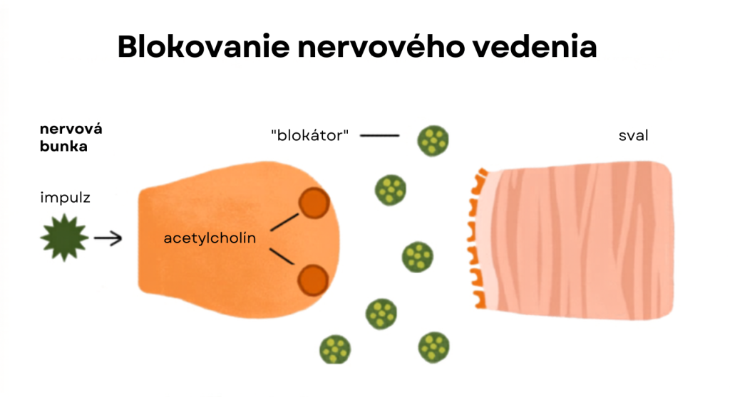 Blokovanie nervovego vedenia 