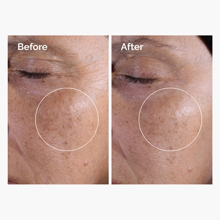 The Ordinary - Glycolic Acid 7% Exfoliating Toner - Tonikum s 7% kyselinou glykolovou - 100ml