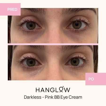 HanGlow - Darkless - Pink BB Eye Cream - Krémový korektor pod oči - 15ml