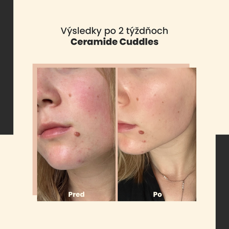 SkinTra - Ceramide Cuddles - Regeneračné sérum - 30ml
