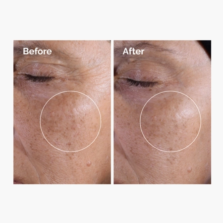 The Ordinary - Glycolic Acid 7% Exfoliating Toner - Exfoliačné tonikum so 7 % kyselinou glykolovou - 240 ml