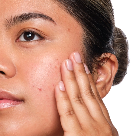 The Ordinary - Salicylic Acid 2% Solution - Sérum s kyselinou salicylovou - 30ml