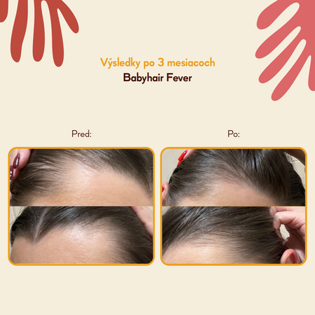 HairTry - Babyhair Fever - Rozohrievajúce tonikum pre rast vlasov - 100ml