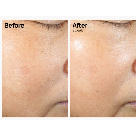 The Ordinary - Rice Lipids + Ectoin Microemulsion - Mikroemulzia s ryžovými lipidmi a ektoínom - 60ml