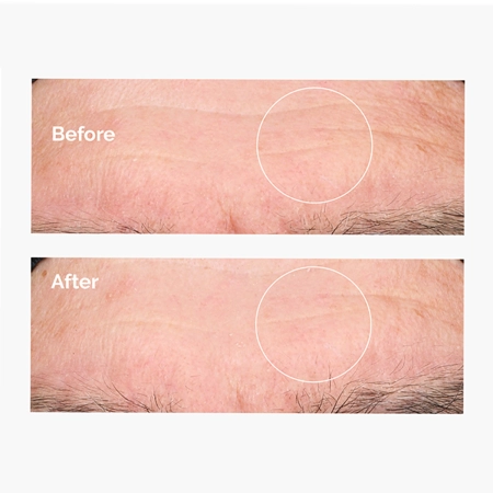 The Ordinary - Hyaluronic Acid 2% + B5 - Hydratačné sérum s kyselinou hyalurónovou 2% a vitamínom B5 - 60 ml