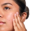 The Ordinary - Salicylic Acid 2% Solution - Sérum s kyselinou salicylovou - 30 ml