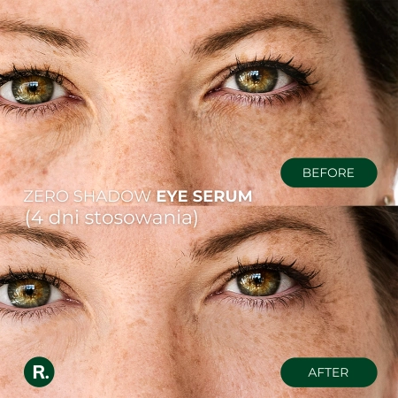 Ralls - Zero Shadow Eye Serum - Sérum pod oči - 20ml