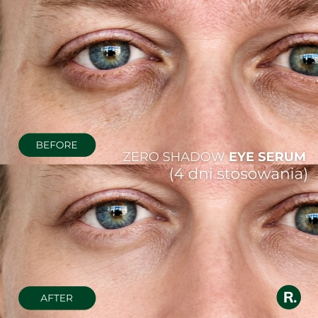 Ralls - Zero Shadow Eye Serum - Sérum pod oči - 20ml