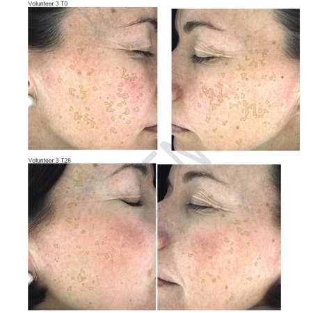 Nerds. - Hyperpigmentation Serum - 2% Alpha Arbutin + 1% Kojic Acid - Sérum na pigmentové škvrny a sfarbenia s 2% alfa-arbutínom a 1% kyselinou kojovou - 30ml
