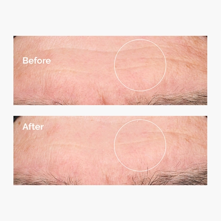 The Ordinary - Hyaluronic Acid 2% + B5 - Hydratačné sérum s kyselinou hyalurónovou 2% a vitamínom B5 - 30 ml