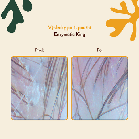 HairTry - Enzymatic King - Enzymatický trychologický peeling s ficínom - 100ml