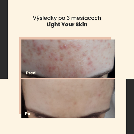 SkinTra - Light Your Skin - Sérum s 20% vitamínom C a kyselinou ferulovou - 30ml