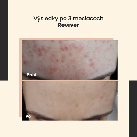 SkinTra - Reviver - Revitalizačné sérum - 30ml
