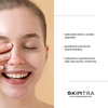 SkinTra - Sada produktov 